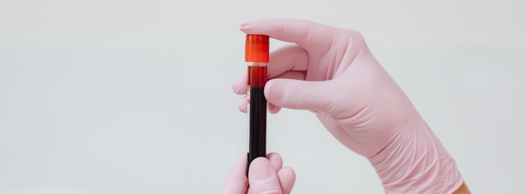 Langzeitblutzucker (HbA1c)